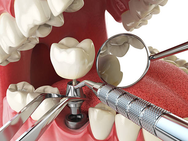 Best After-Hours Emergency Dentist in Wesson, MS